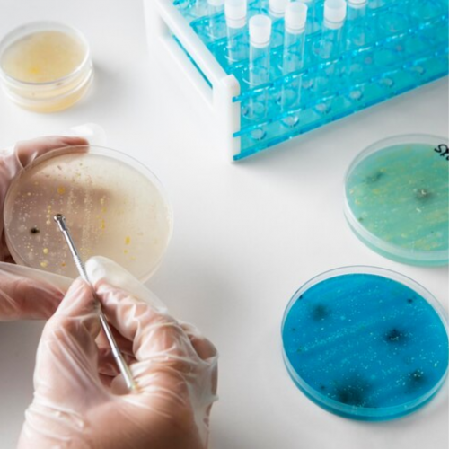 O Impacto do Avan&ccedil;o das Pesquisas em Microbiologia na Sa&uacute;de