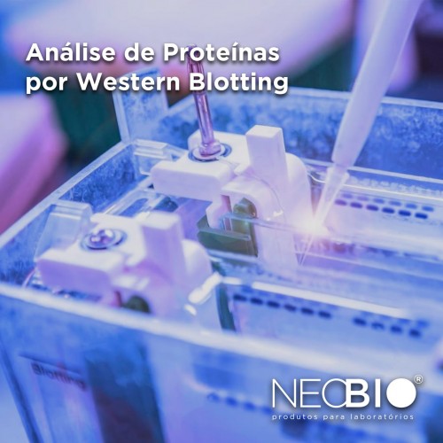 An&aacute;lise de prote&iacute;nas por Western Blotting